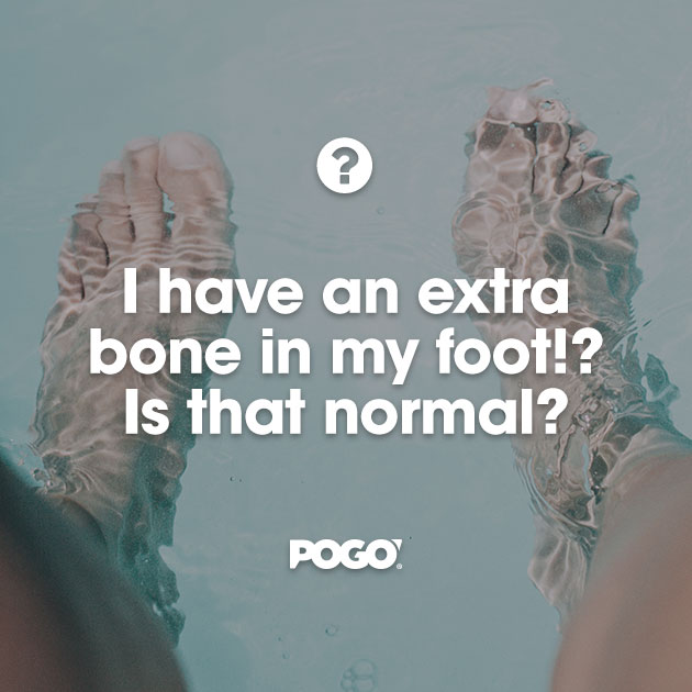 extra bone