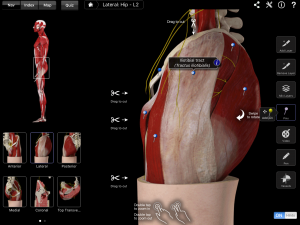 ITB Friction Syndrome 