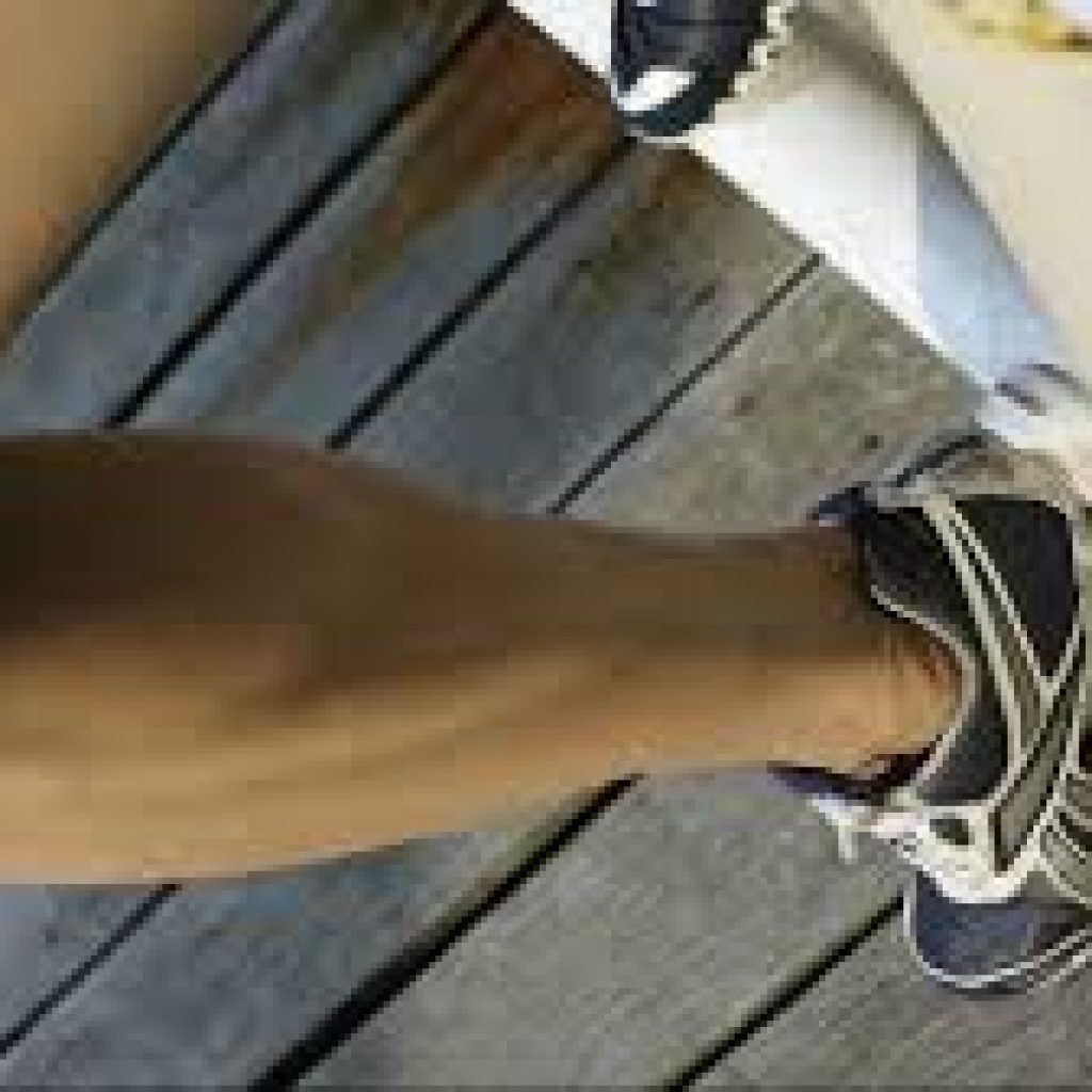 Achilles Tendon