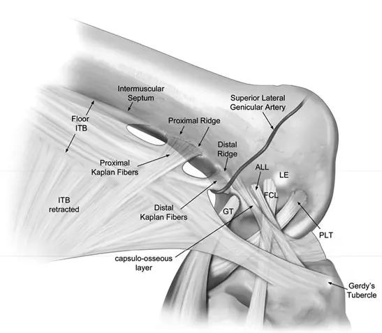 Anterolateral Ligament (ALL) as shown from a lateral/outside view