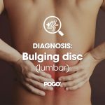 Bulging Disc
