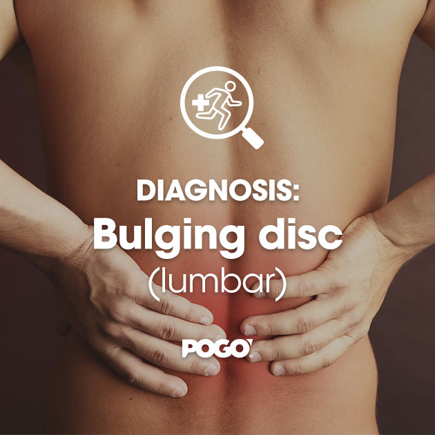 Bulging Disc