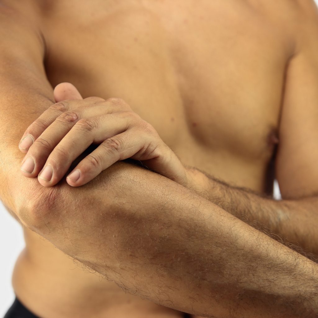 tennis elbow