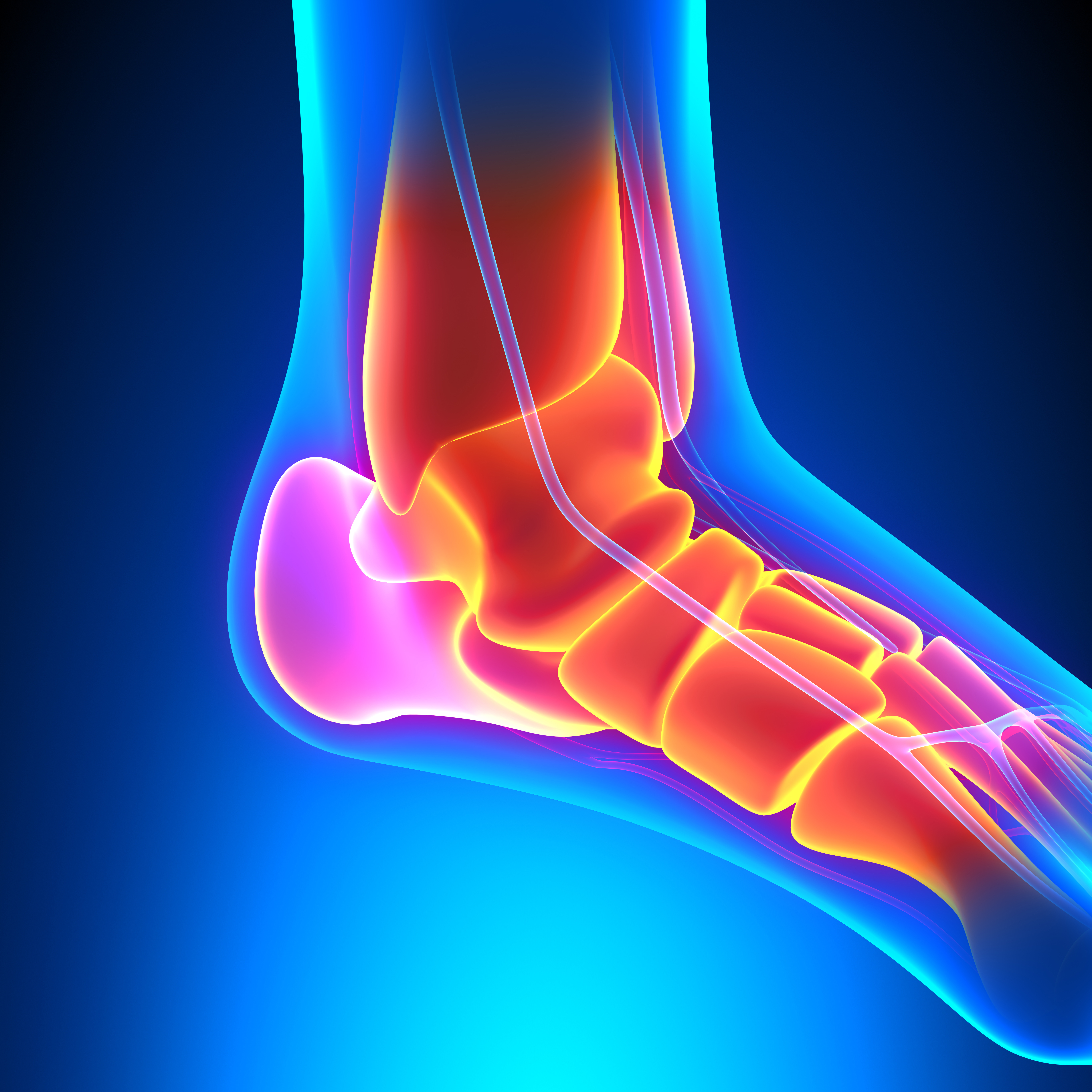 Podiatry Gold Coast foot picture