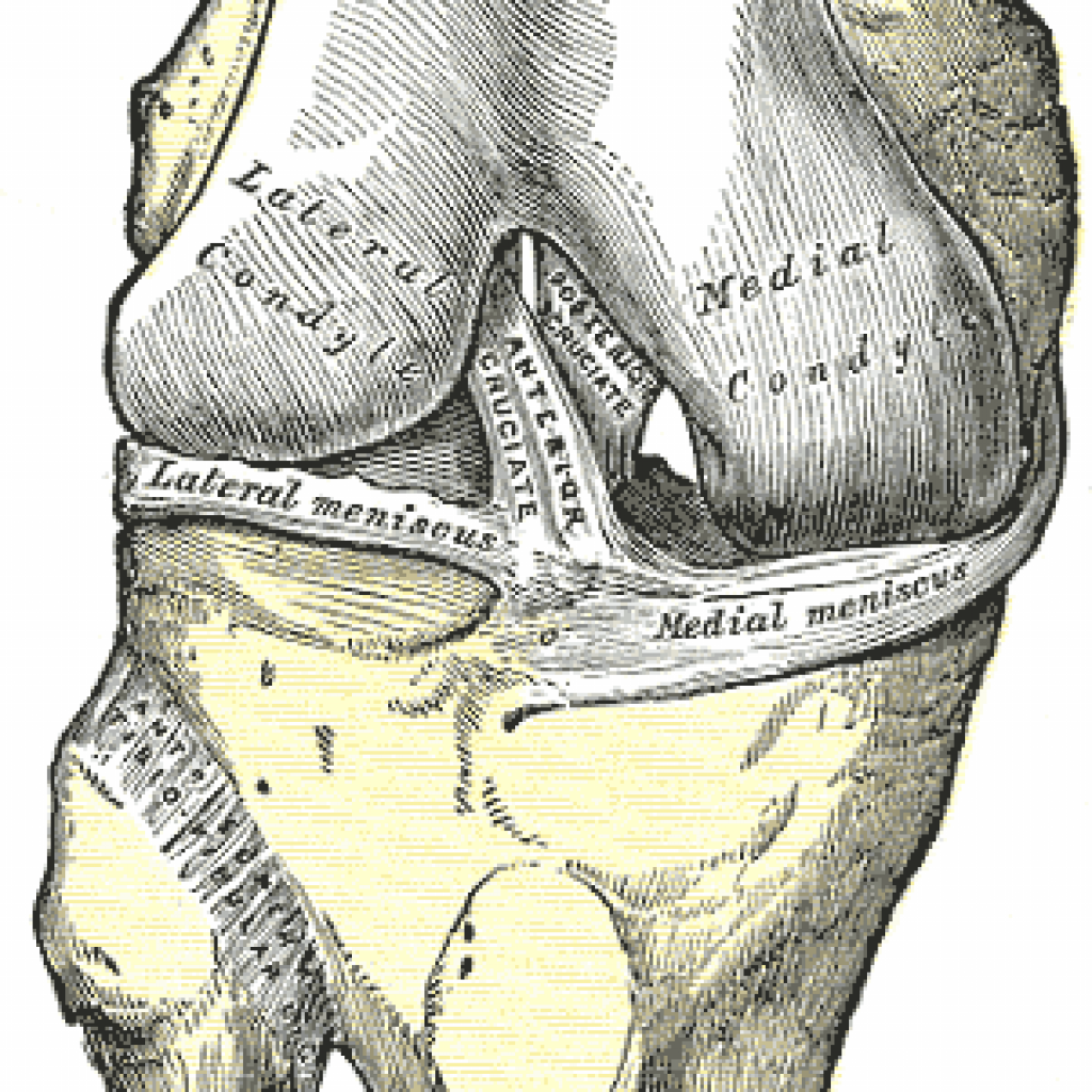 ACL Injury