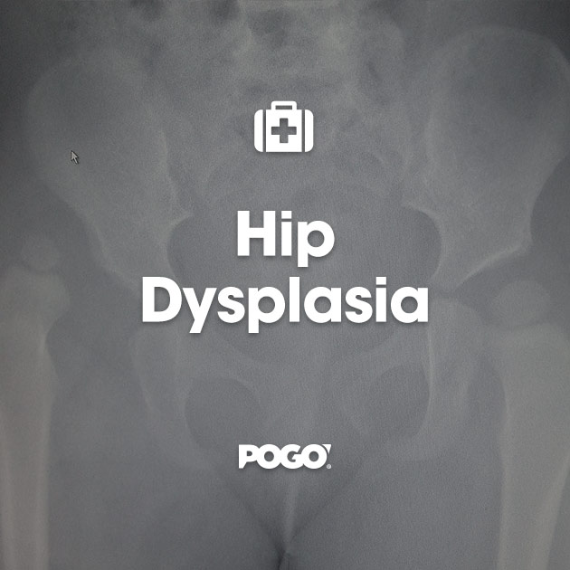 Hip Displasia