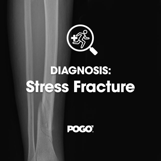 Diagnosis Stress Fracture POGO Physio Gold Coast