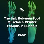 plantar fasciitis