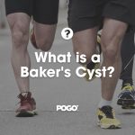 Bakers Cyst