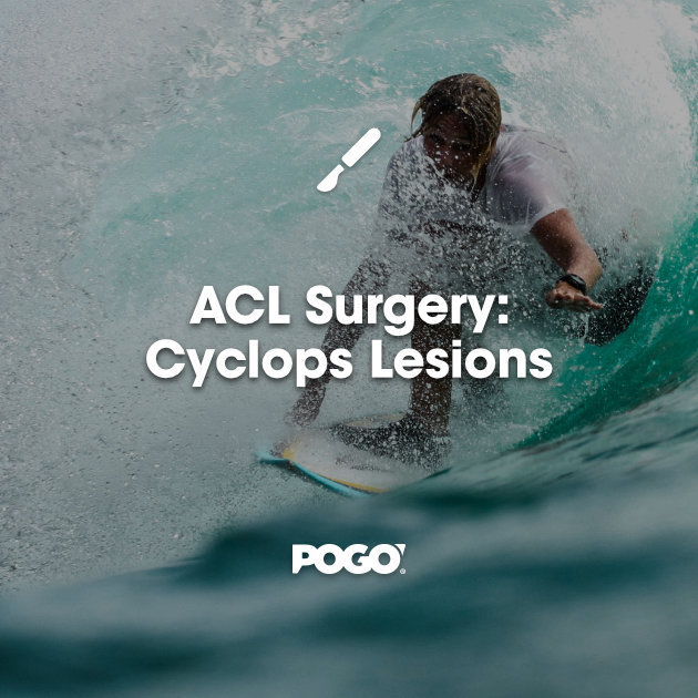 acl surgery