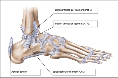 Lateral Ankle Ligament Sprains Part 1 POGO Physio Gold Coast