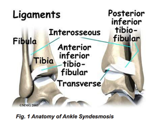 Ankle Syndesmosis Injuries