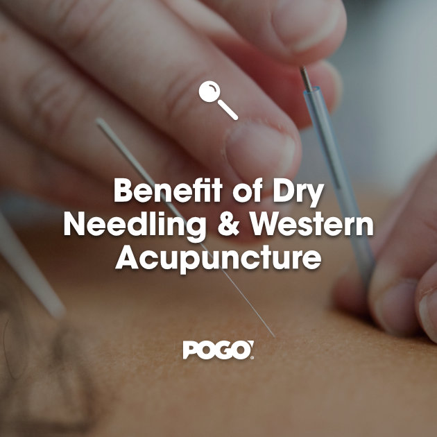 Dry Needling