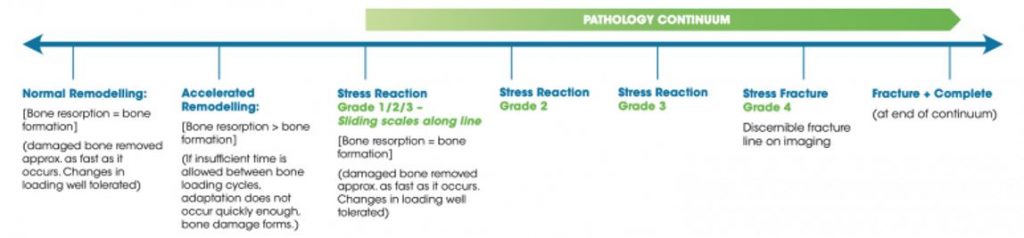 Bone Stress Injuries