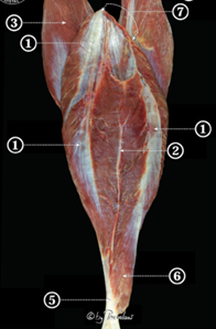 calf muscle strain injury
