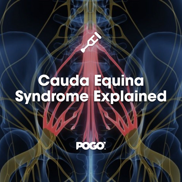 Cauda Equina Syndrome Explained Pogo Physio Gold Coast