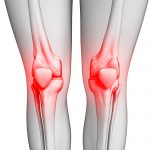 Osgood Schlatter
