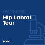Hip Labral Tear