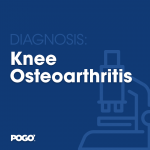 Knee Osteoarthritis