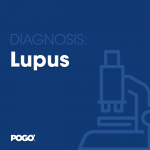 Lupus