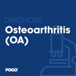 osteoarthritis
