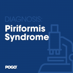Piriformis syndrome