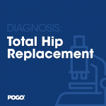 total hip replacement
