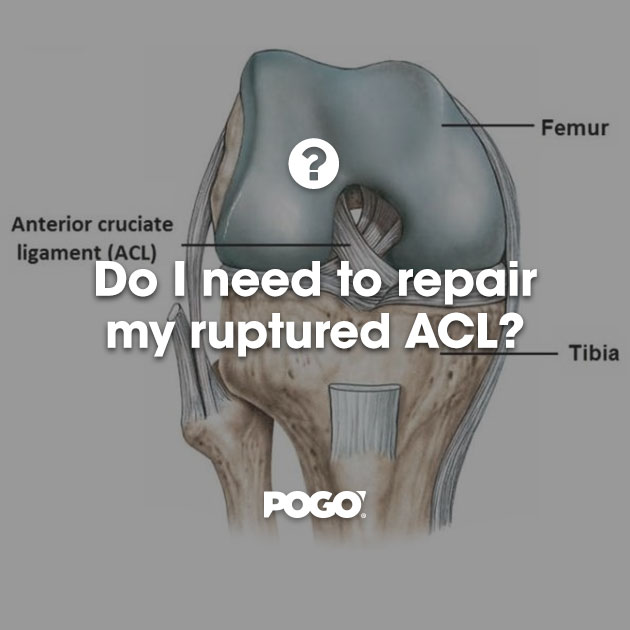 Ruptured ACL