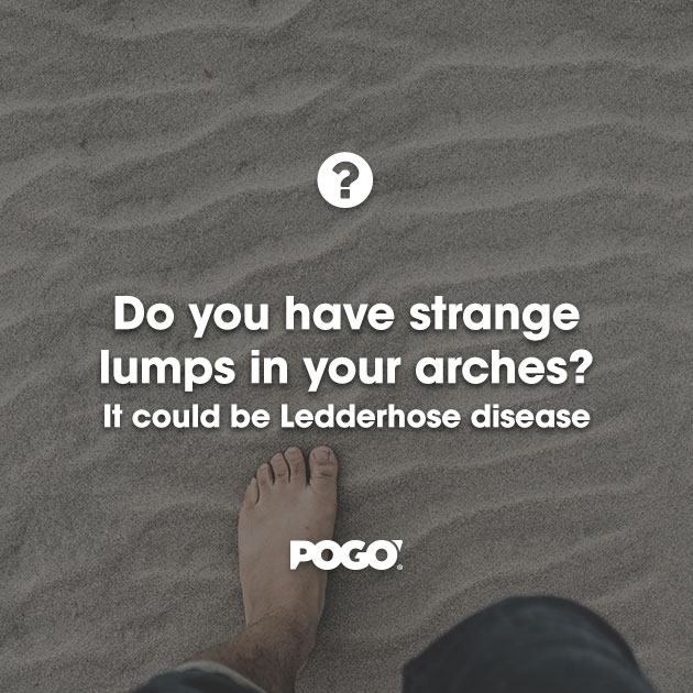 Ledderhose Disease