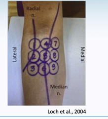 Elbow Pain