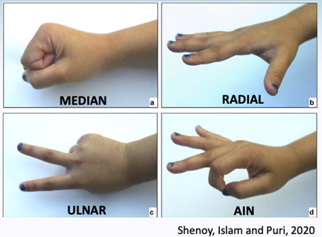 Elbow Pain