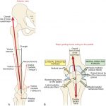knee pain