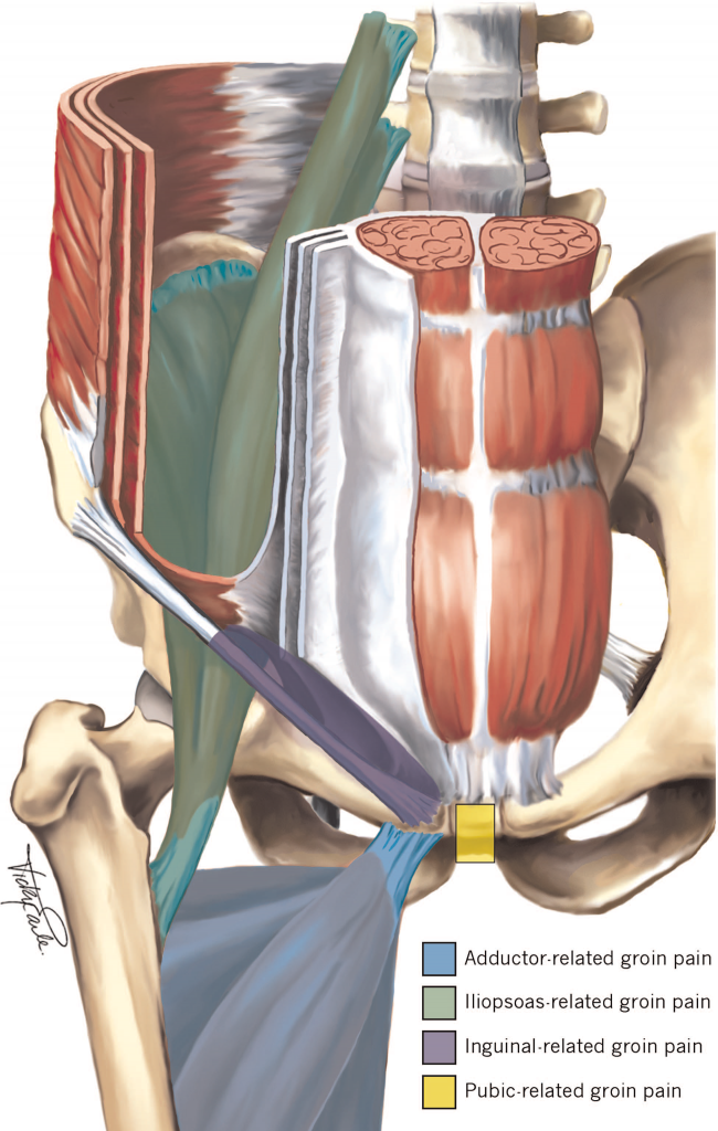 Hip and Groin Symposium 2017: Part 1 Diagnosis of Hip and ...