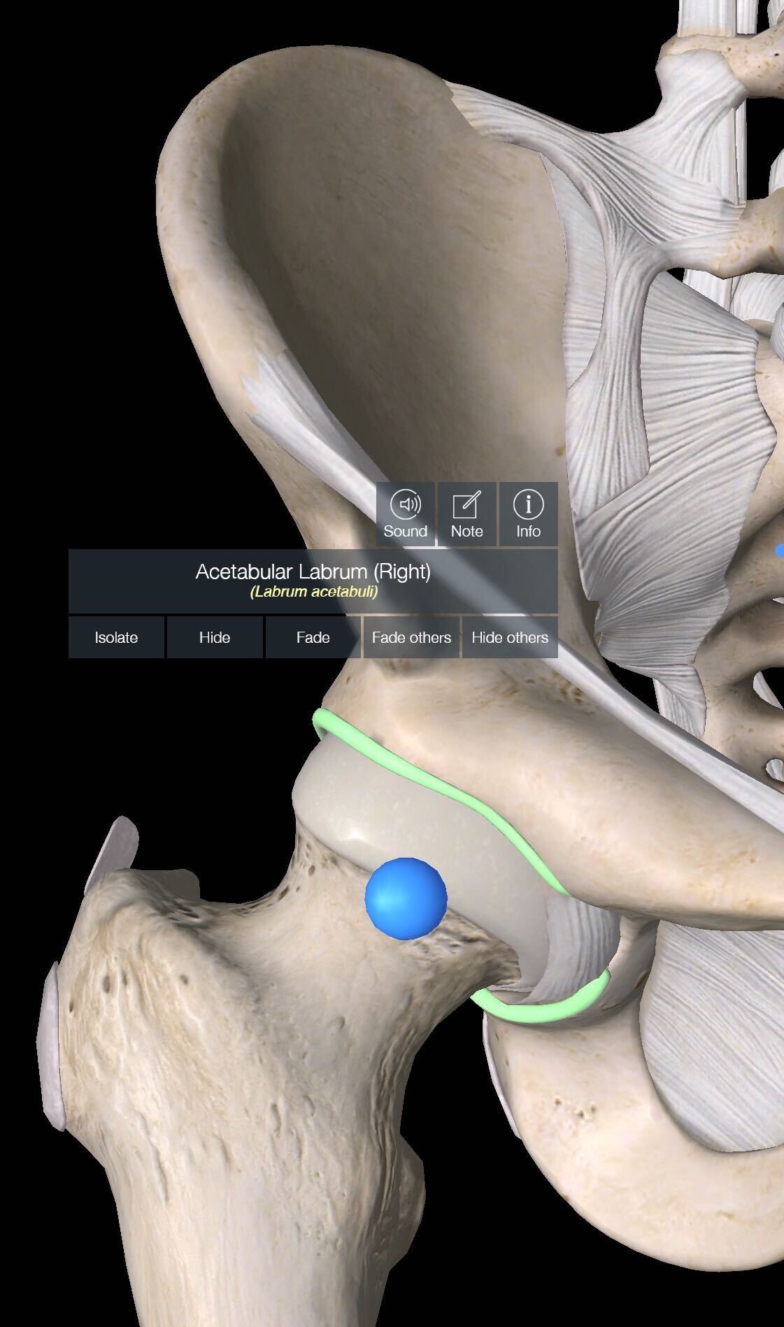 Hip Dysplasia