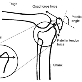 ITB Friction Syndrome…what is it?