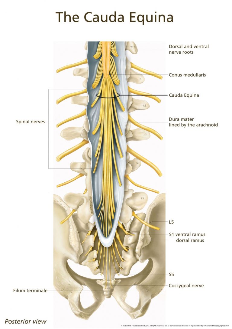 Cauda Equina Syndrome: Explained | POGO Physio Gold Coast