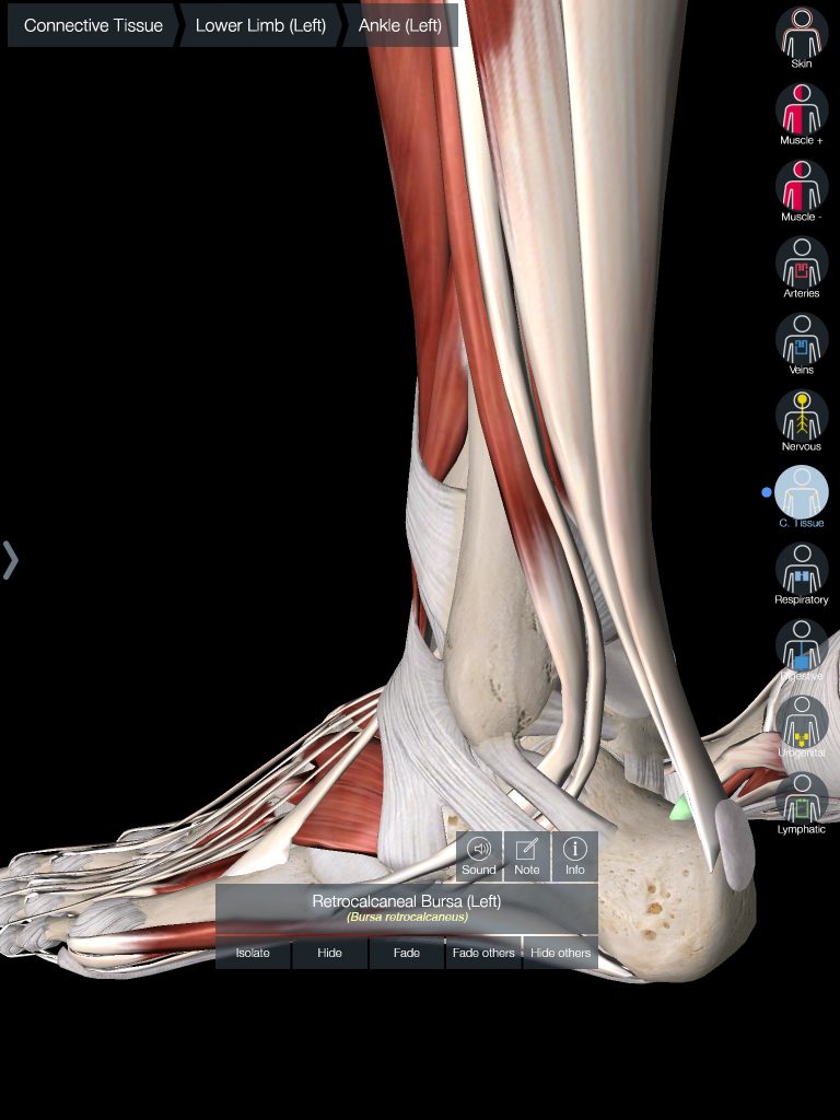 Tendon degeneration