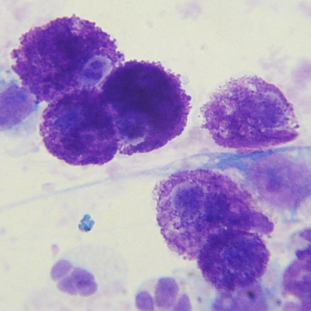 mast cell 