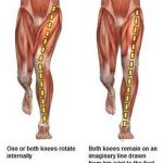 knee pain