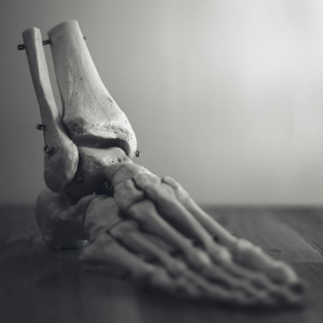Lisfranc Injury
