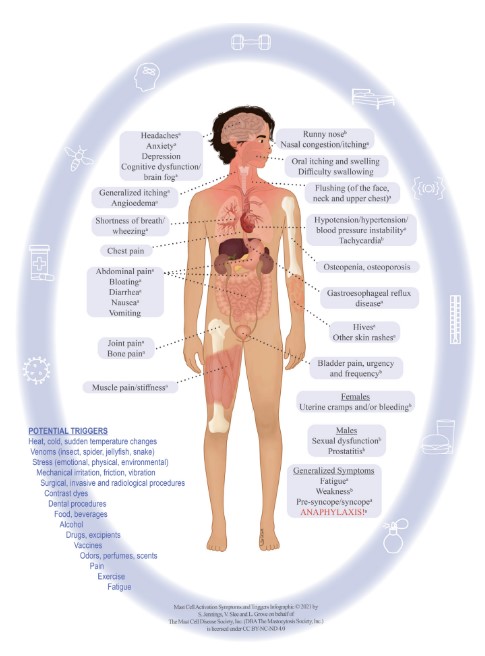 mast cell