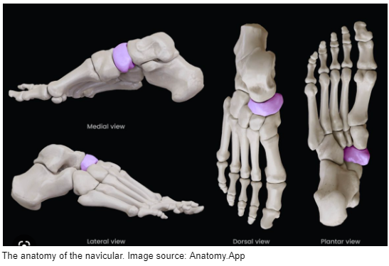 Navicular bone stress