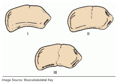 Navicular bone stress