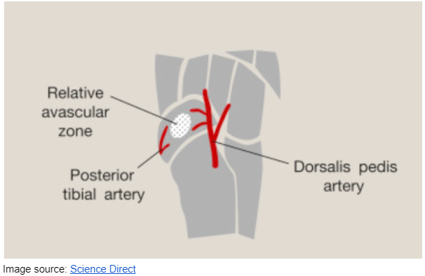 Navicular bone stress