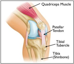 Osgood Schlatter's