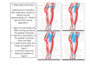 Tendinopathy