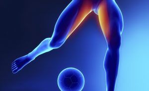 Sports Hernia