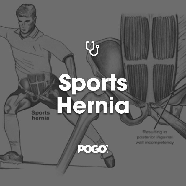 Sports Hernia  POGO Physio Gold Coast