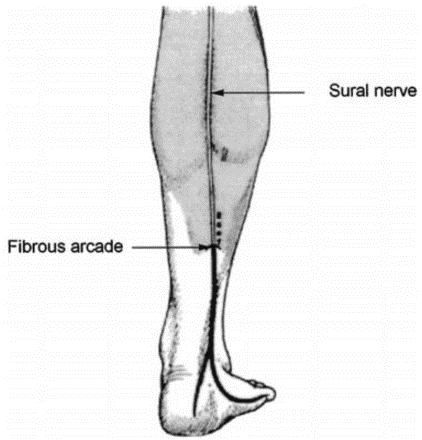 Sural Nerve