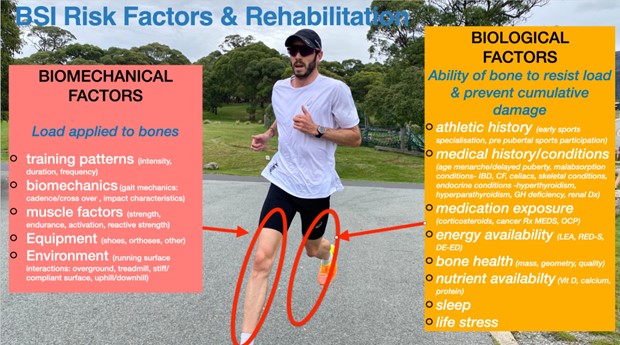 Tibial Bone Stress